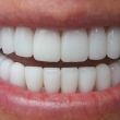 Esztétikai fogászat, fogorvos, fogszabályozás, fogpótlás 11. kerület